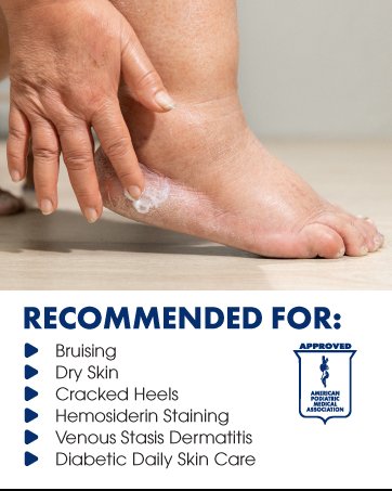 Recommedended for bruising, dry skin, cracked heels venous stasis, diabetic skin