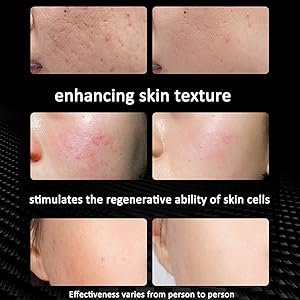 Red Light Therapy Lamp